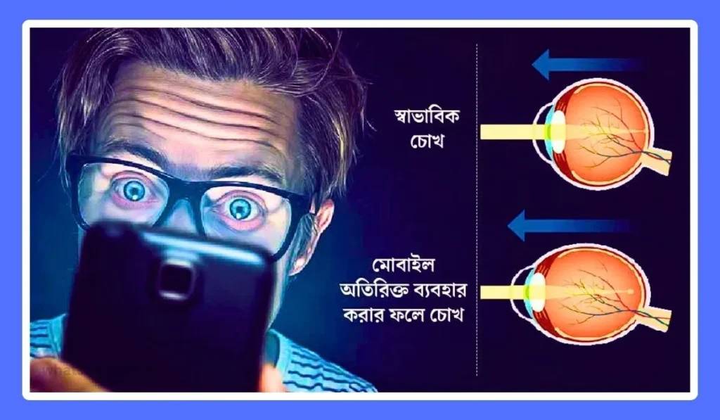 চোখের ক্ষতি এড়াতে মোবাইল ফোন ব্যবহারের নীতিমালা (নিয়ম)